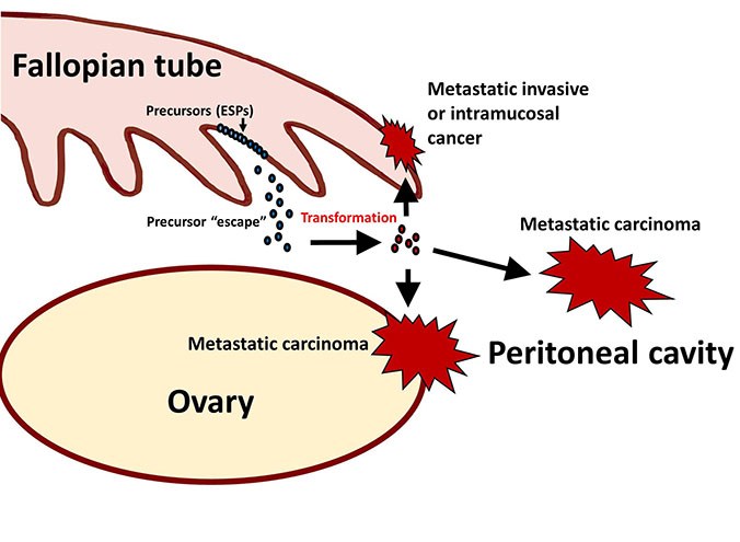 drawing of HGSC, tumors being created