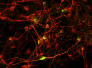 microscope image of neurons