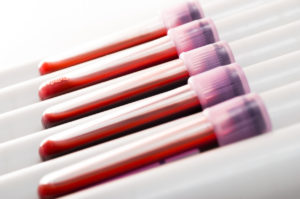 Blood samples in laboratory (coagulation test)