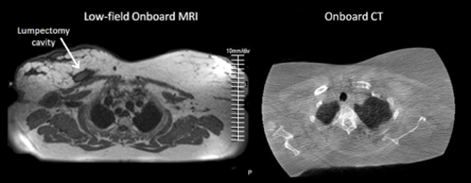 New MR-Imaging (Left) – Traditional Cone-beam CT (Right)