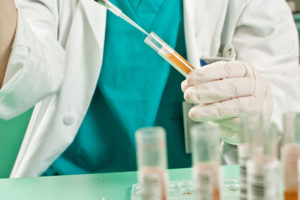urine test tube