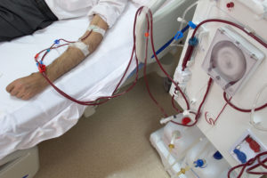 person receiving dialysis