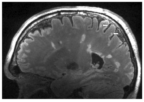 エビデンスからせまる肝のMRI 416pevJYzIL._AC_SY200_QL15_.jpg