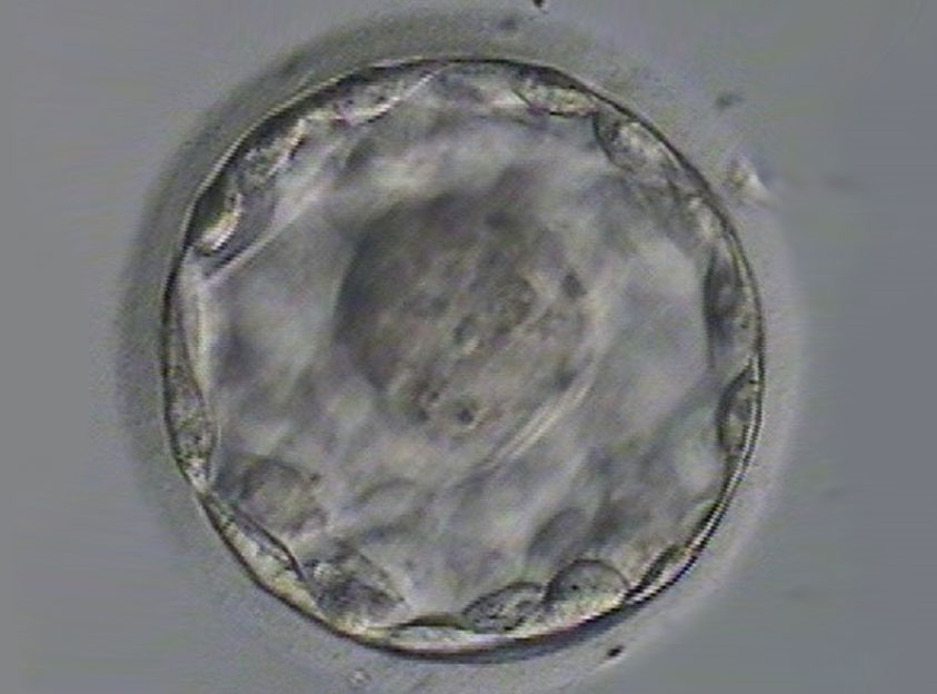 Fresh Embryos From Fresh Donor Eggs Improve IVF Birth Rates Brigham