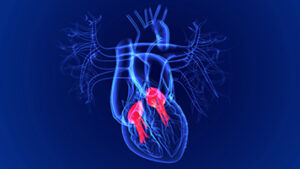 Tricuspid Valve