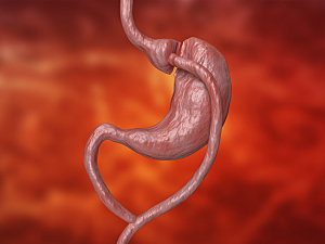 3d Rendering of gastric bypass on red background