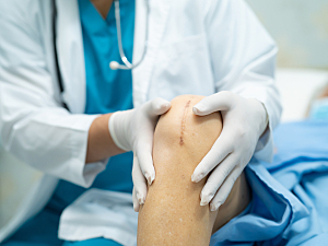 Doctor evaluates patient knee suture scar after total knee arthroplasty