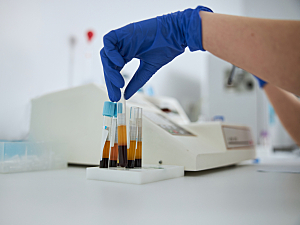Researcher in lab setting selecting from upright plasma samples on table