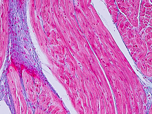 Microscopic image of human heart muscle