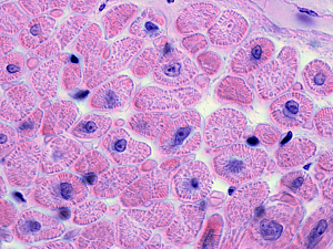 Hematoxylin and eosin–stained biopsy of muscle fibers of heart myocardium