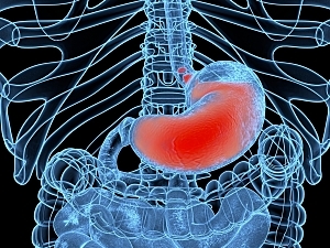 Blue outline of human anatomy showing GERD highlighted red, acid reflux in stomach