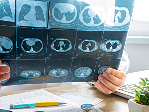 Doctor examing ct scan images of lungs at desk, lung disease concept