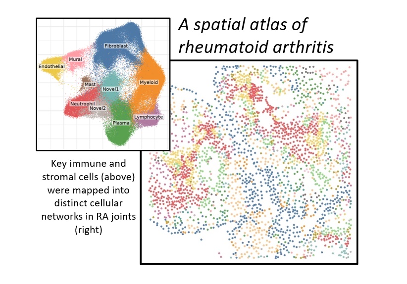 spatial atlas of rheumatoid arthritis (RA), with cells mapped into cellular networks in RA joints