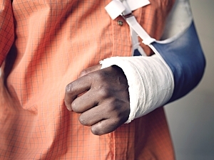 Closeup midsection of a man with broken arm in cast, orthopedic trauma recovery