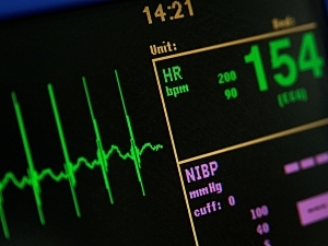 Heart monitor measuring vital signs, 154 bpm, hypertension concept