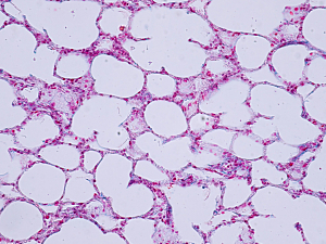 Human lung tissue under microscope view for education histology. Human tissue.